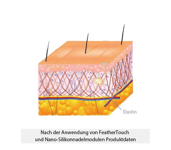 Nach deiner Anwendung