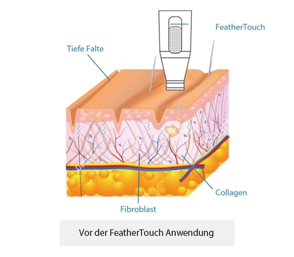 Vor deiner Anwendung